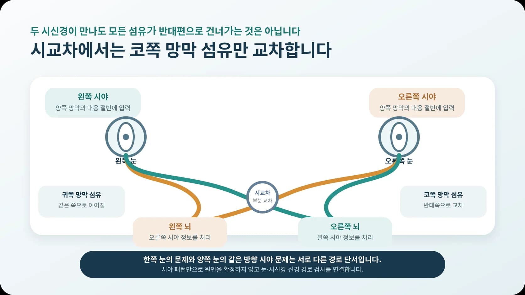 코쪽 망막 섬유만 시교차에서 교차해 왼쪽 시야는 오른쪽 뇌로 오른쪽 시야는 왼쪽 뇌로 모이는 과정