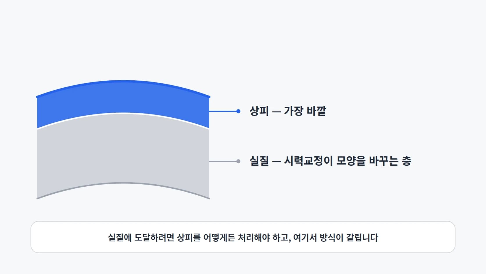 각막의 상피와 실질 두 층을 단순화해 그린 단면 모식도