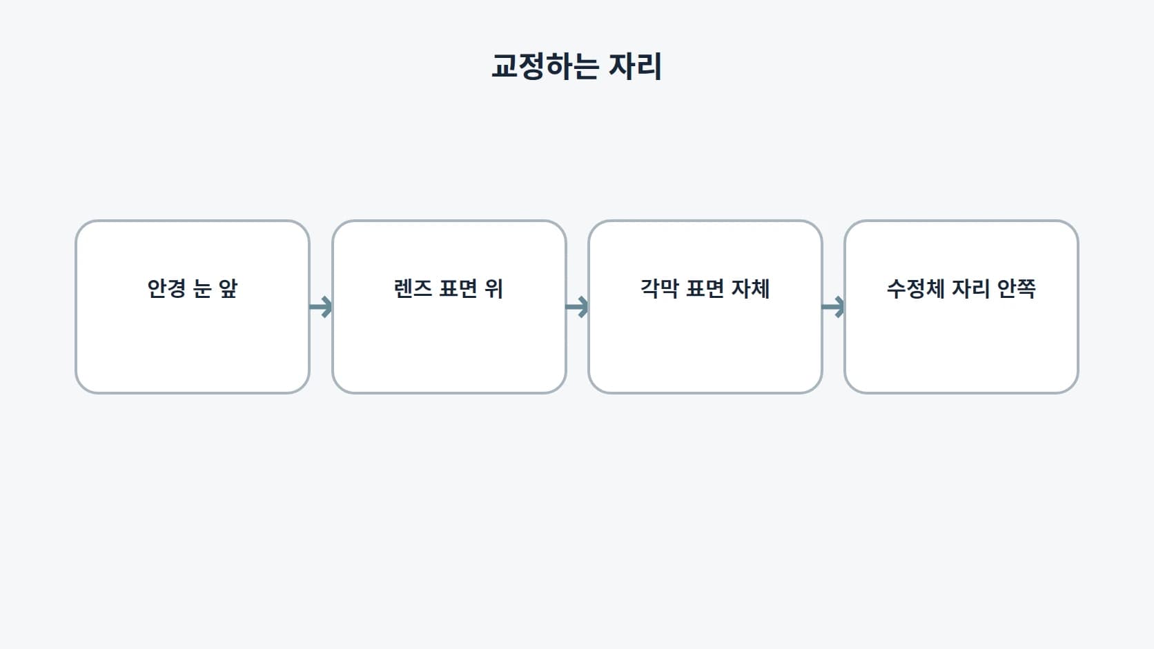 난시를 교정하는 자리가 안경·콘택트렌즈·각막·인공수정체로 나뉨을 왼쪽에서 오른쪽 순서의 네 지점으로 표시한 도해