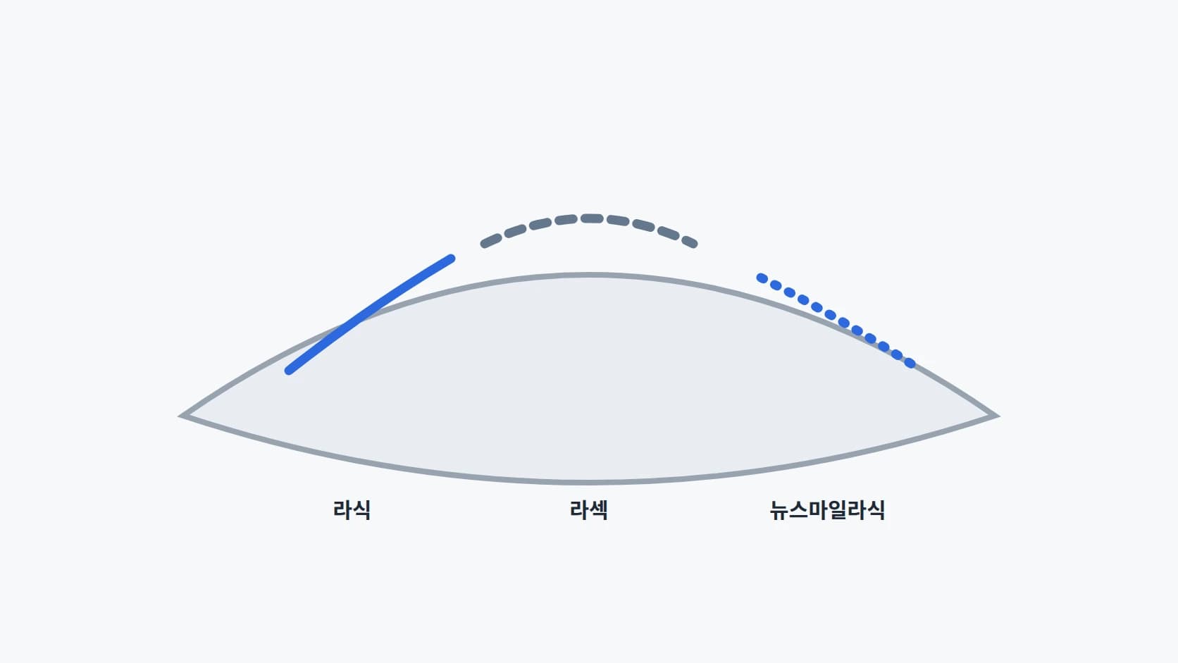 세 가지 방식이 각막의 어느 위치에 접근하는지 부분 단면 세 개를 나란히 놓아 비교한 도해