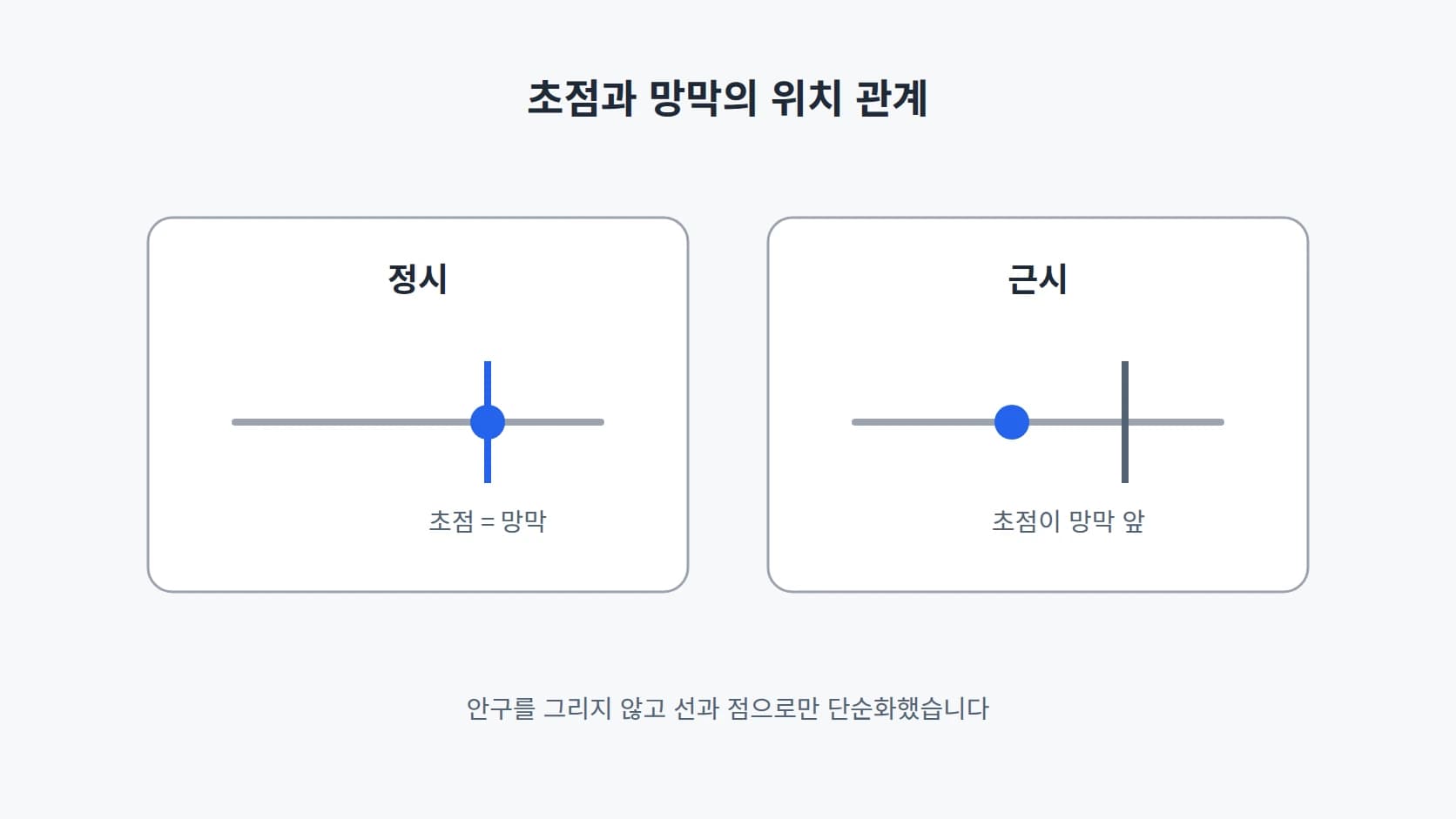 수평선 하나 위에 초점과 망막의 위치를 점으로 표시해 정시와 근시를 좌우로 비교한 도해
