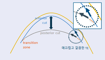 아토스 장비 특징 2