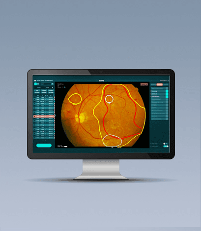 인공지능 안저검사 VUNO Fundus AI