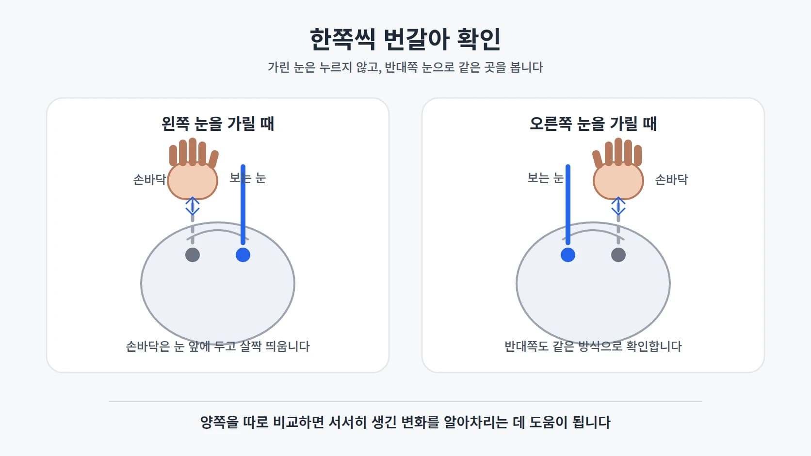저녁 실내에서 한쪽 눈을 손바닥으로 가리고 반대쪽 눈으로 앞을 보는 사람