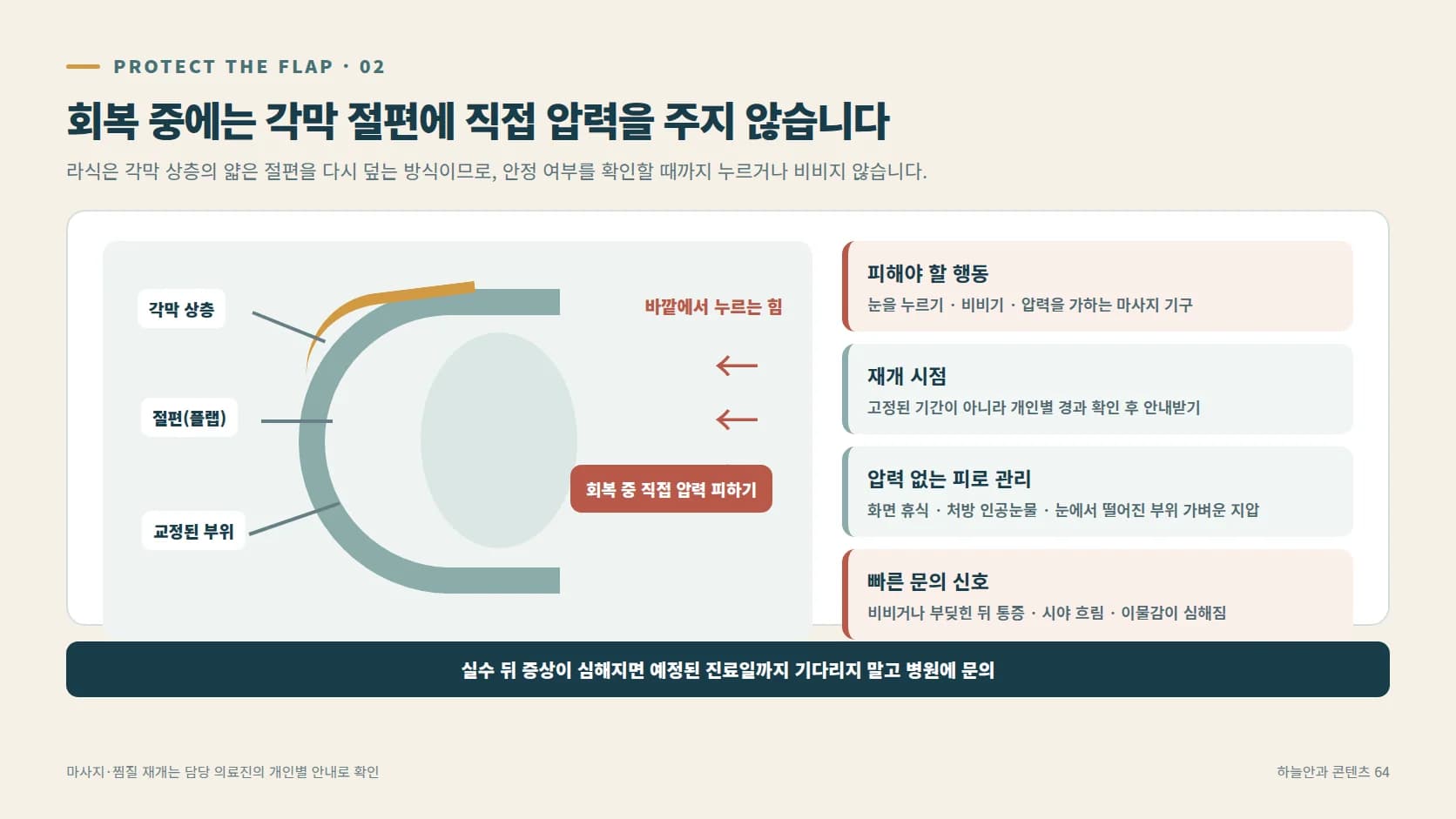 각막 절편이 있는 부위를 보호하는 개념을 보여주는 그래픽