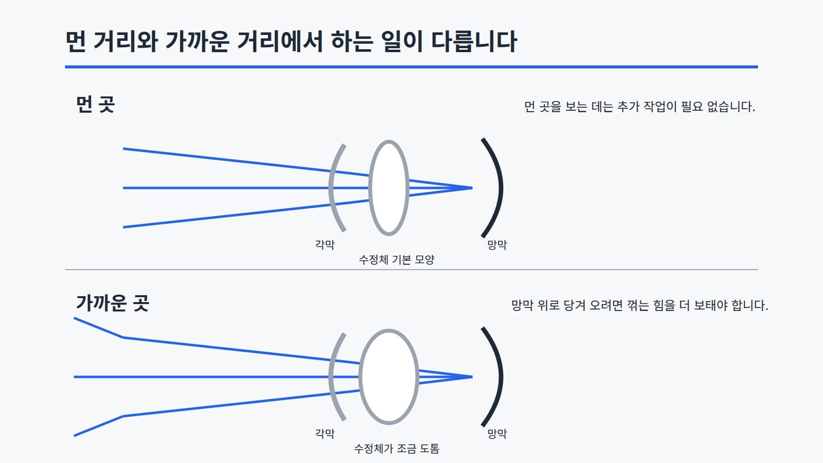 위쪽 먼 곳과 아래쪽 가까운 곳으로 나눠 들어오는 빛의 방향과 수정체 모양의 차이를 단순 기하로 작도한 2단 도해